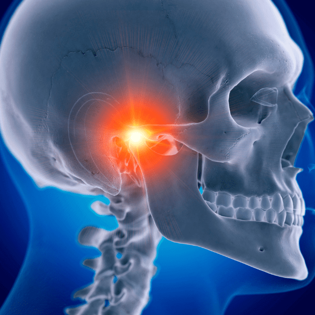Sea One Family Chiropractic The TMJ Fix Most People Never Try Treating The Neck Behind The Jaw Pain